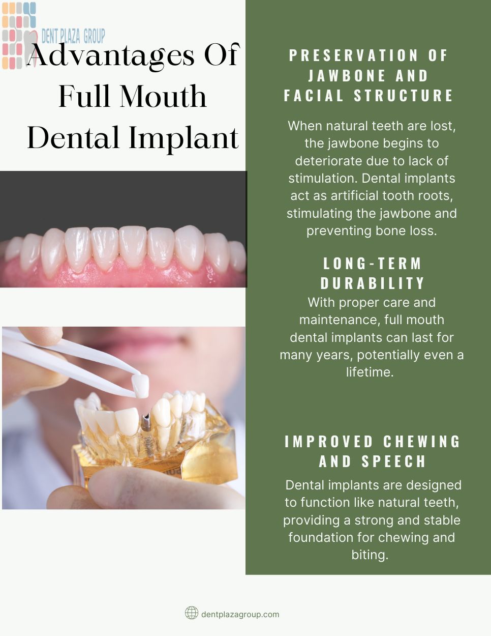 advantages of full mouth dental implant