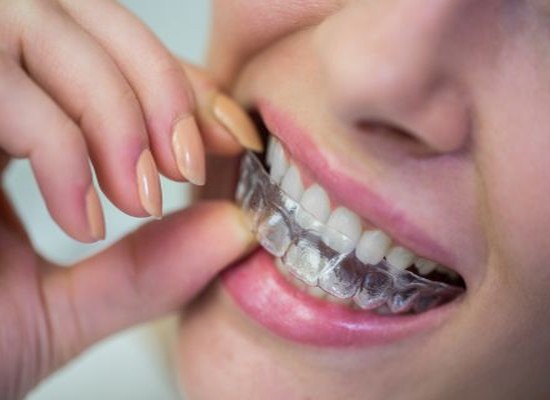 Ortodonti, diş teli tedavisi nasıl yapılır? fiyatları Antalya